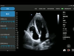 sonda senza fili portatile di ultrasuono 3.6MHz sincronizzata - trasduttore di matrice