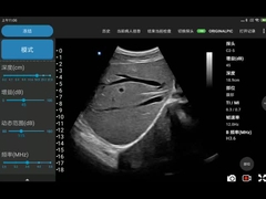 Dispositivo senza fili di ultrasuono di matrice convessa elettronica per il telefono cellulare
