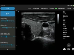 256 linee di scansione sonda senza fili di ultrasuono del trasduttore di ultrasuono di Ipad per PICC
