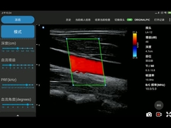 matrice lineare elettronica Iphone degli analizzatori senza fili di ultrasuono di 12MHz