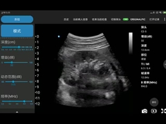 Il CE ha segnato il png MPEG-4 del BMP del JPEG portatile degli analizzatori di ultrasuono di 3.6MHz Wifi