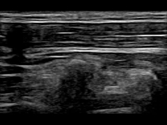 Macchina portatile a distanza 30 Fps di ultrasuono di doppler di WiFi 12.6cm