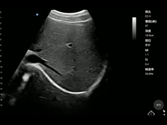 Analizzatore tenuto in mano di salute della sonda convessa portatile dell'apparecchio medico ISO13485