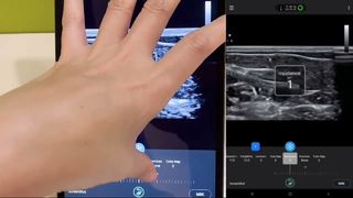 Sonda ecografica lineare Golead per vena basilica