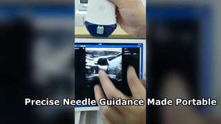 Palm Sized Wireless Ultrasound for Precise Needle Guidance
