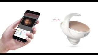 Marvoto Fetus Camera M1 - Ecografo portatile 3D