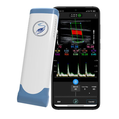 comprare Scanner a ultrasuoni portatile wireless da 12 MHz per iPhone e iPad | Sonda elettronica per color doppler a matrice lineare online manufacture