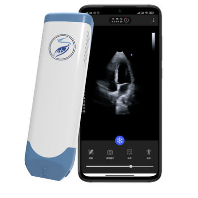 comprare Scanner a ultrasuoni portatile Wireless Phased Array Ultrasuoni cardiaci tascabili da 5 MHz per ecocardiografia POCUS online manufacture