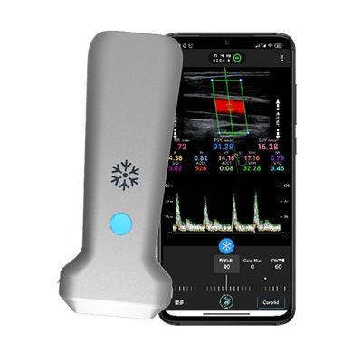 comprare Scanner a ultrasuoni Doppler a colori portatile lineare wireless WiFi | Imaging in tempo reale a 30 FPS | Sonda ecografica medica portatile online manufacture