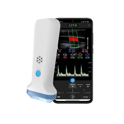 comprare Scanner a ultrasuoni portatile lineare wireless | Sonda ecografica portatile Color Doppler 4/8,3/12 MHz online manufacture