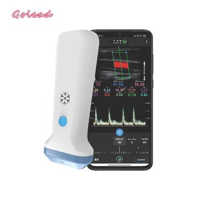 comprare tipo senza fili analizzatore della sonda di 12MHz 3000mAh di ultrasuono per Iphone online manufacture