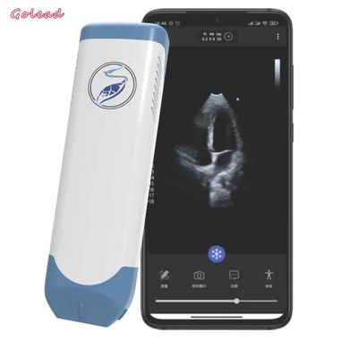 comprare sonda senza fili portatile di ultrasuono 3.6MHz sincronizzata - trasduttore di matrice online manufacture