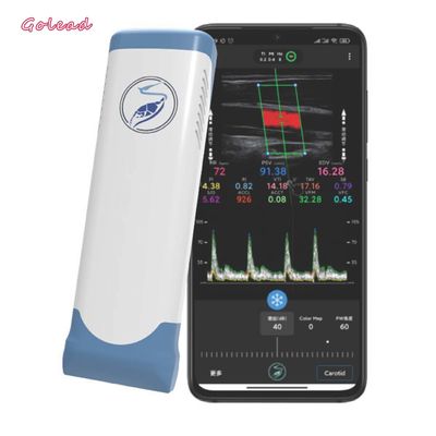 comprare Analizzatore portatile senza fili elettronico 12MHz di ultrasuono di Wifi di matrice lineare online manufacture