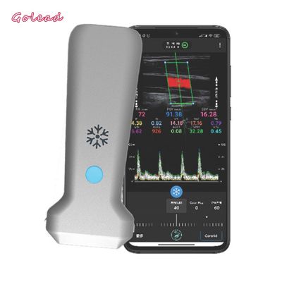 comprare analizzatore convesso di ultrasuono della sonda di 126mm per il nervo vascolare di MSK online manufacture