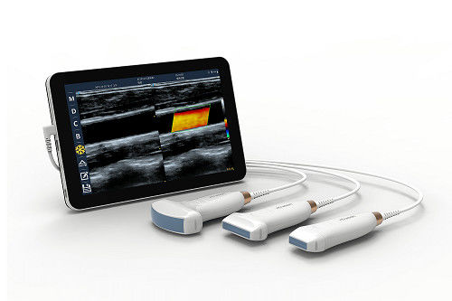 comprare Sonda ad ultrasuoni portatile Android da 10 MHz per scanner ad ultrasuoni lineare USB tipo C per vascolare e POCUS online manufacture