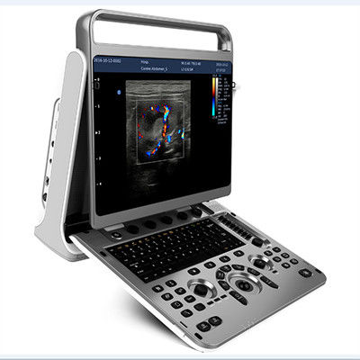 comprare Macchina portatile Chison EBit 30 di ultrasuono di progettazione ergonomica online manufacture