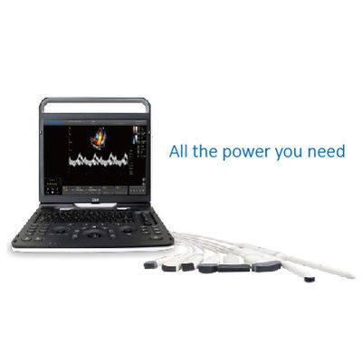 comprare Ultrasuono Chison EBit 60 di Wifi di 128 elementi per cardiovascolare online manufacture