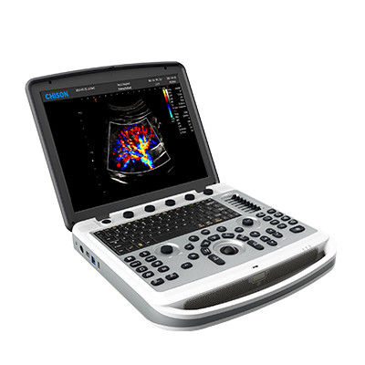 comprare Macchina rotabile di ultrasuono del computer portatile del portatile di 120° Chison SonoBook 6 online manufacture