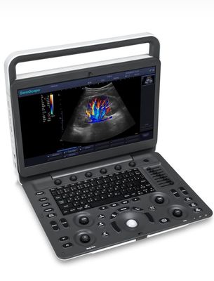 comprare ultrasuono di BW della macchina di ultrasuono di 15.6inch LED Sonoscape E1 Exp online manufacture