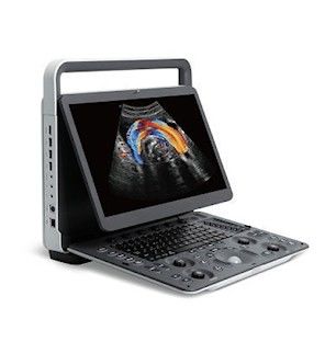 comprare Macchina portatile panoramica di ultrasuono di SonoScape E2 di rappresentazione PRO online manufacture