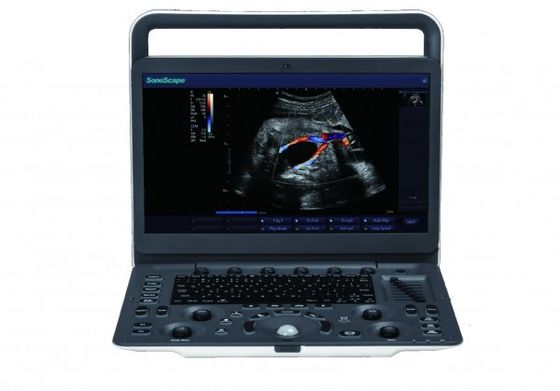 comprare 7 macchina portatile di ultrasuono di SonoScape E3 dei livelli di rappresentazione con il monitor a 15,6 pollici online manufacture