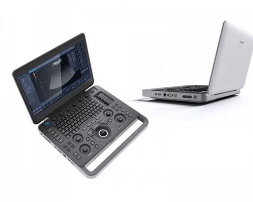 comprare Smart avvista la macchina di ultrasuono di SonoScape del computer portatile 500GB con 15,6» LCD online manufacture