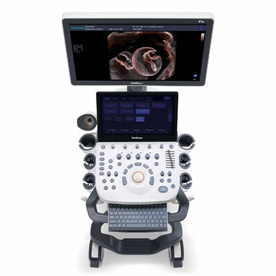 comprare macchina di ultrasuono di 4D Elastography SonoScape per OB'e la ginecologia online manufacture