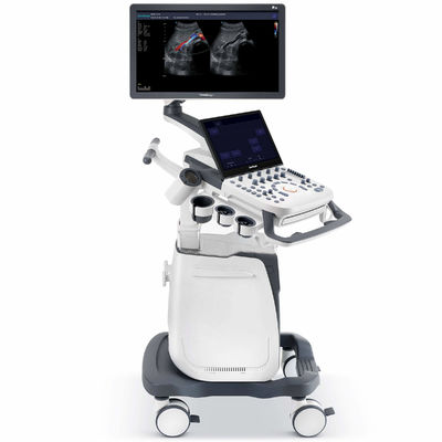comprare Macchina composta spaziale P25 di ultrasuono di SonoScape di rappresentazione 500GB online manufacture