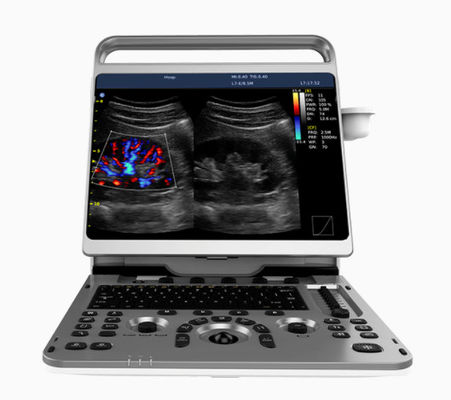 comprare Macchina cardiaca portatile Chison EBit di ultrasuono 50 16.5lbs online manufacture