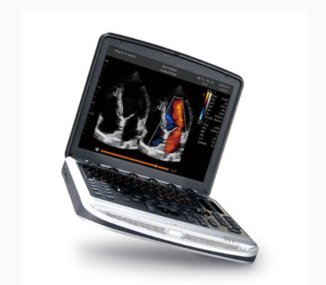 comprare Macchina approvata dalla FDA Chison SonoBook 8 di ultrasuono del computer portatile per ecocardiografia online manufacture