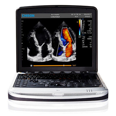 comprare Facile portare la macchina di ultrasuono del computer portatile di 4D Chison SonoBook 9 online manufacture