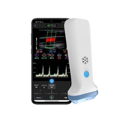 comprare Scanner per ultrasuoni lineare wireless portatile Color Doppler Ultrasuoni POCUS portatili da 12,6 cm per operatori sanitari online manufacture
