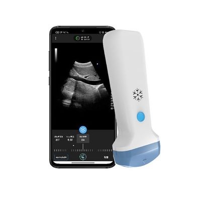 comprare HDMI Output Wireless Convex Handheld Ultrasound Scanner 3.6MHz Portatile Doppler Color POCUS Ultrasound online manufacture