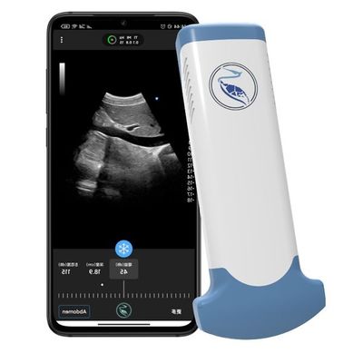 comprare Analizzatore tenuto in mano di ultrasuono della medicina MPEG-4 di emergenza per uso diagnostico clinico online manufacture