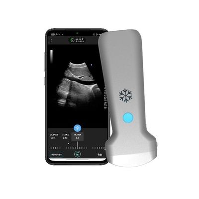comprare Scanner a ultrasuoni portatile convesso wireless ISO13485 | Sonda ecografica portatile Color Doppler online manufacture