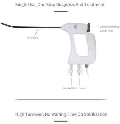 comprare Isteroscopio elettronico eliminabile 4.8mm del CE ISO13485 della FDA per le procedure endoscopiche di ginecologia online manufacture