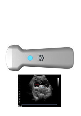 comprare Sonda senza fili convessa di ultrasuono di Ultrasonication per la ginecologia online manufacture