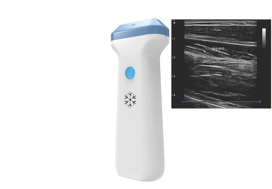 comprare Sonda 80 To180dB di ultrasuono di Wifi dell'elemento del JPEG 128 del png del BMP di DICOM online manufacture