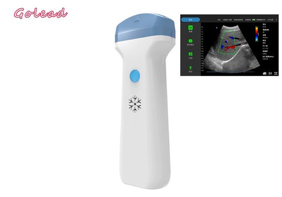 comprare Sonda senza fili di ultrasuono di Ipad di anestesia per pronto intervento degli esami di POCUS online manufacture