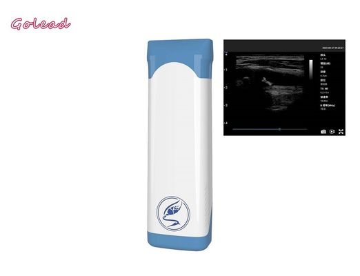 comprare sonda senza fili tenuta in mano di ultrasuono 12MHz per le ispezioni all'aperto online manufacture