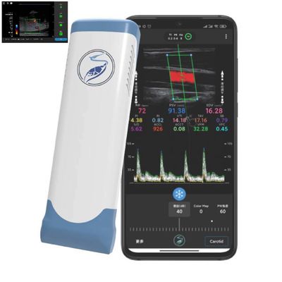 comprare 256 linee di scansione sonda senza fili di ultrasuono del trasduttore di ultrasuono di Ipad per PICC online manufacture
