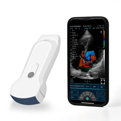 comprare Scanner ad ultrasuoni portatile per iPad portatile POCUS per la diagnosi clinica online manufacture