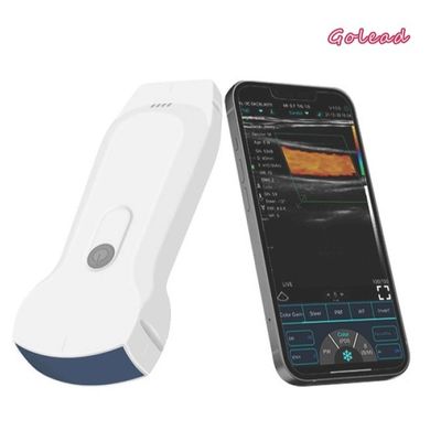 comprare 12 mesi della garanzia di ultrasuono dell'analizzatore 128 degli elementi di ultrasuono tenuto in mano USG di wifi online manufacture