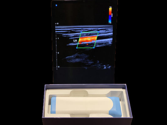 comprare Scanner ad ultrasuoni avanzato a mano da 0,2 kg con batteria da 3000 mAh per uso medico online manufacture