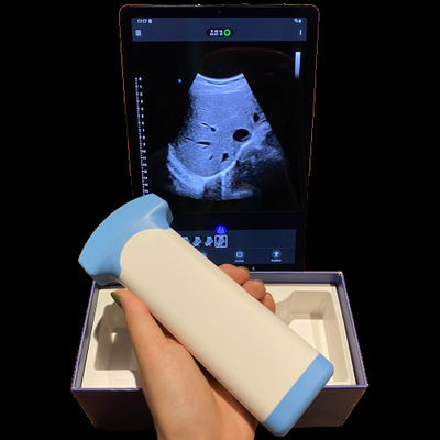 comprare Sonda ad ultrasuoni senza fili per procedure diagnostiche di assistenza primaria online manufacture