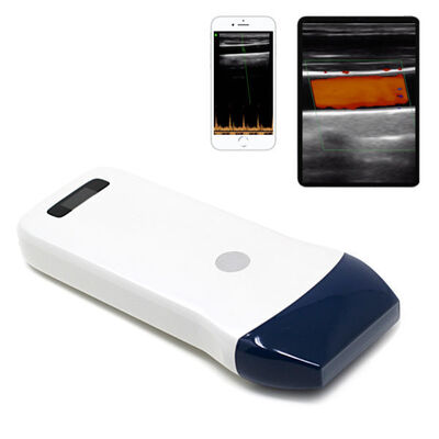 comprare Scanner a ultrasuoni con sonda lineare wireless per accesso vascolare, blocco nervoso e imaging muscoloscheletrico online manufacture