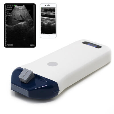 comprare Sistema ad ultrasuoni portatile wireless per la guida dell'ago e procedure interventistiche online manufacture