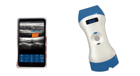 comprare Sonda per ultrasuoni portatile wireless a doppia testa da 128 elementi: una sonda per imaging profondo, imaging superficiale e diagnosi al punto di cura online manufacture