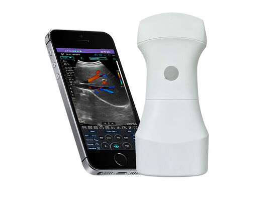 comprare Scanner a ultrasuoni convesso tascabile wireless con batteria sostituibile per imaging clinico portatile online manufacture