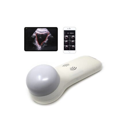 comprare Scanner vescicale portatile wireless 4D per la misurazione del volume urinario al punto di cura online manufacture
